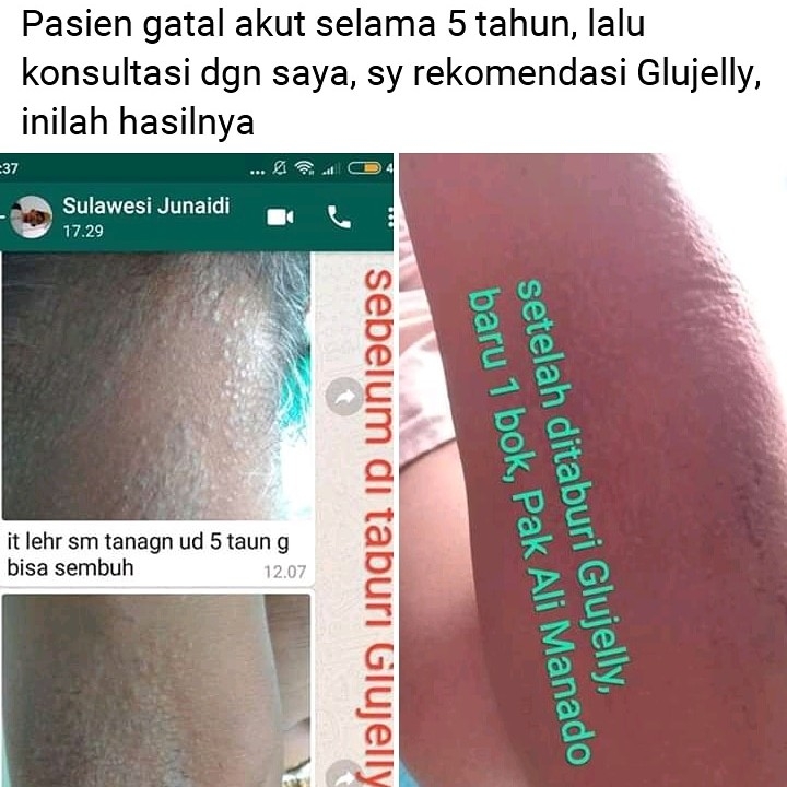 Alergi  Gatal 2