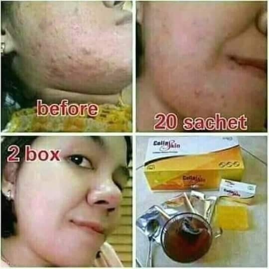 Collagen Skin Care 2