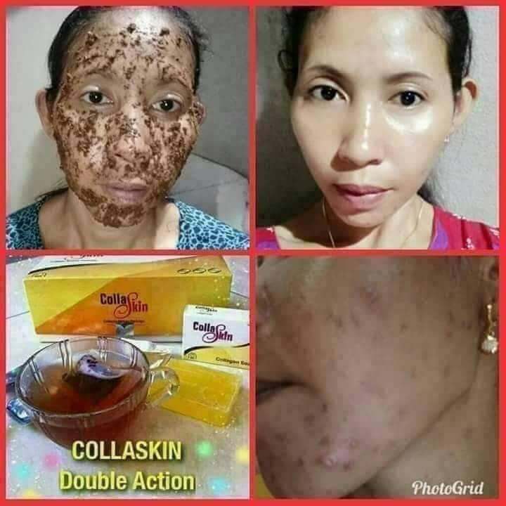 Collagen Skin Care 4