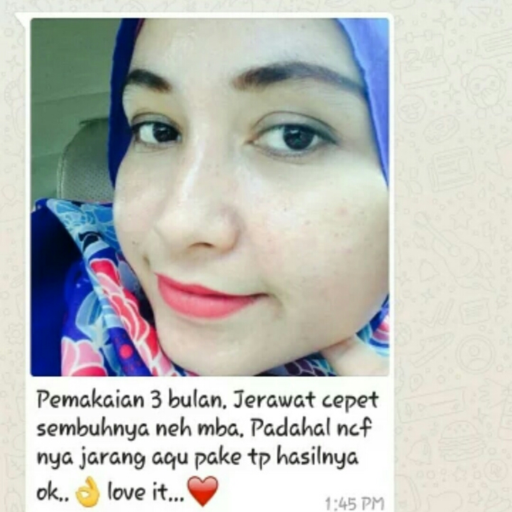 Cream Pembersih Jerawat Dr Nala 4 Series Acne 2