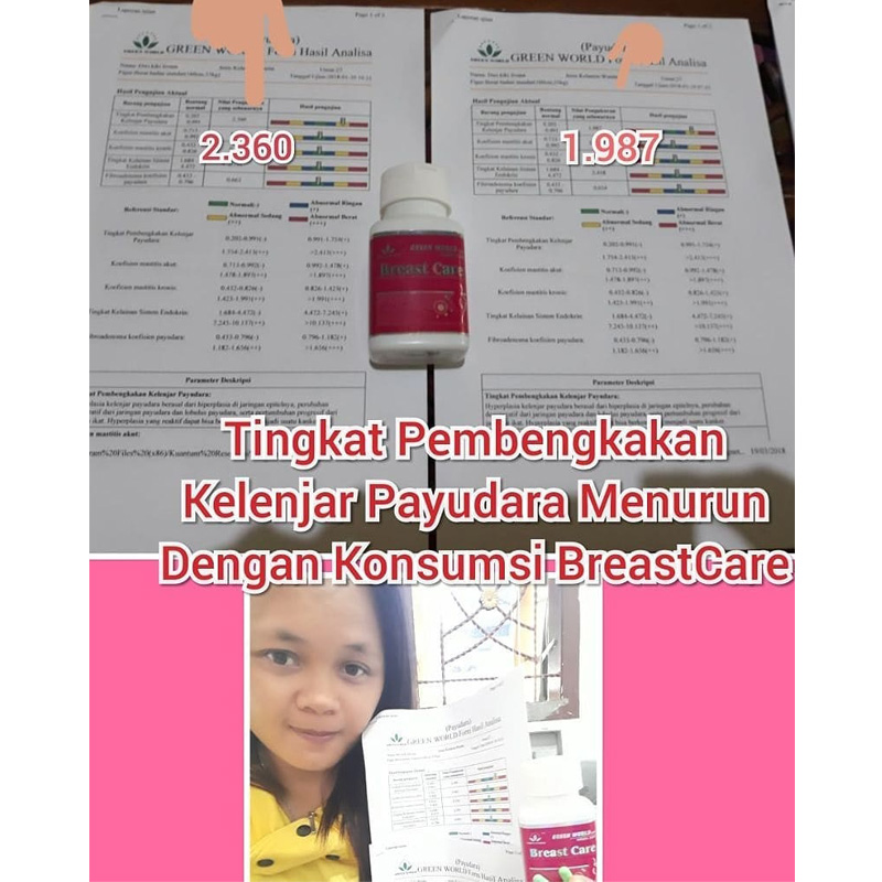 Green World Breast Care Capsule Untuk Merawat Sel Payudara Agar Tetap  2