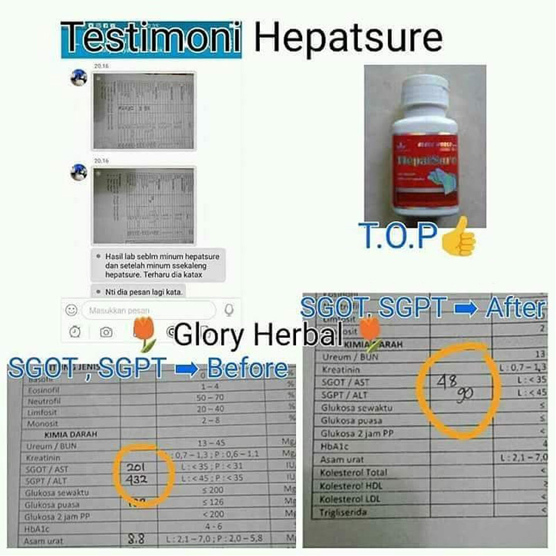 Green World Hepatsure Capsule Untuk Menjaga Fungsi Hati 4