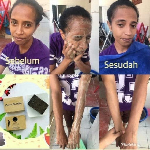 Sabun Beras Hitam Mabello 2