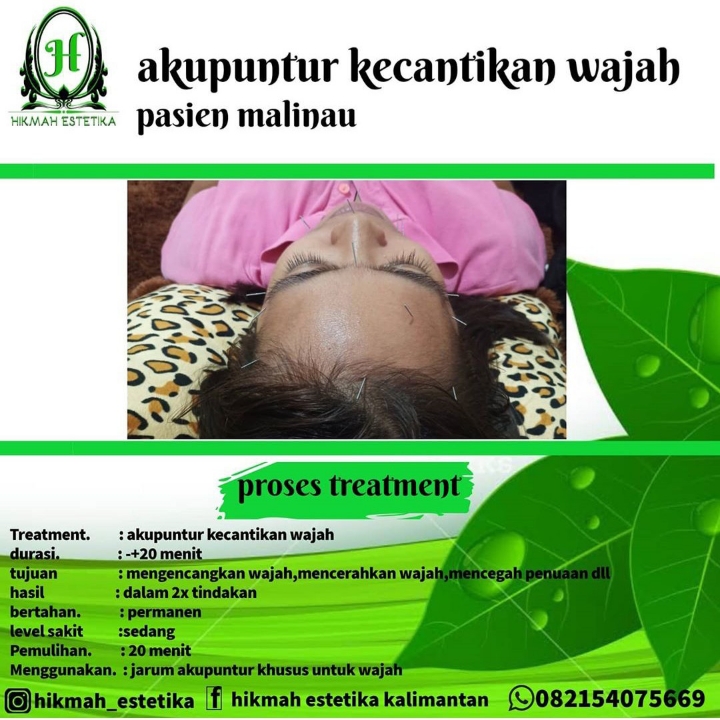 Akupuntur Kecantikan Wajah