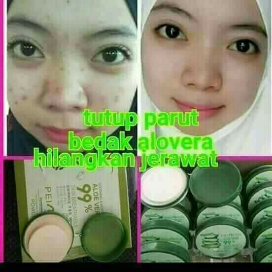 BEDAK ALOEVERA  3