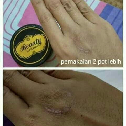 Beauty Lotion