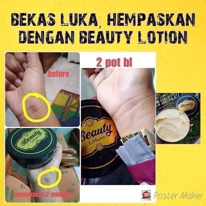 Beauty Lotion 2