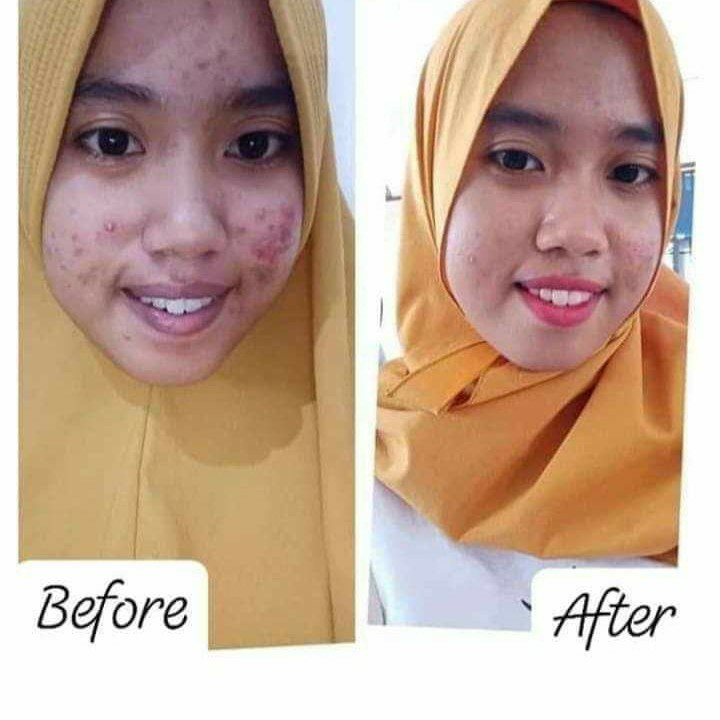 Bebwhitec Skincare Terhitz Masa Kini 4