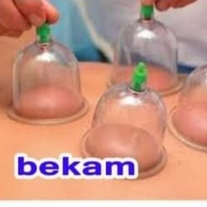 Bekam 