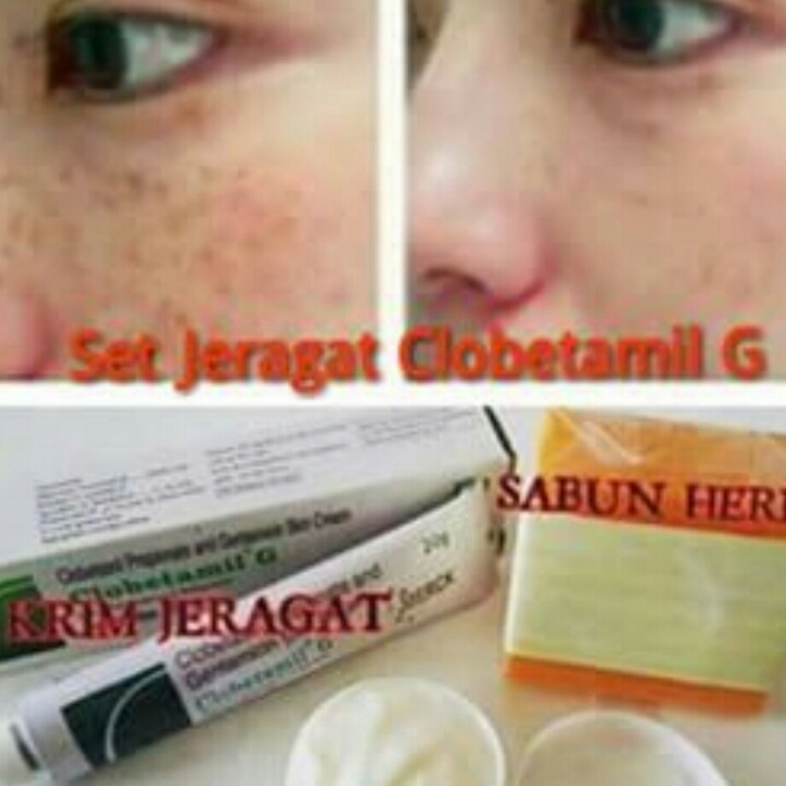 CREAM CLOBETAMIL G