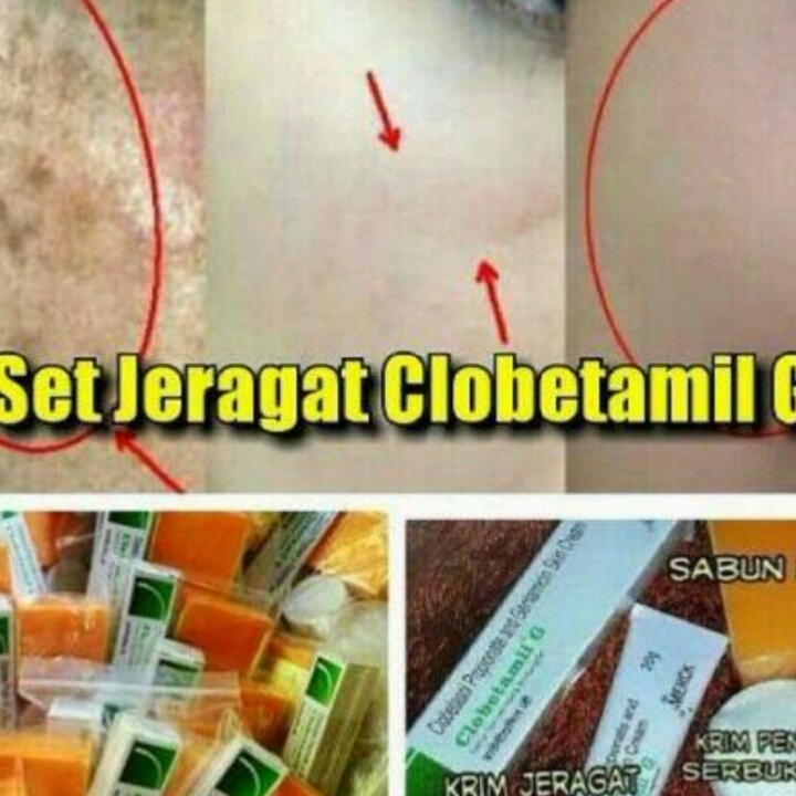 CREAM CLOBETAMIL G 2