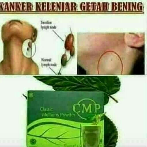 Cmp Detox Racun 3