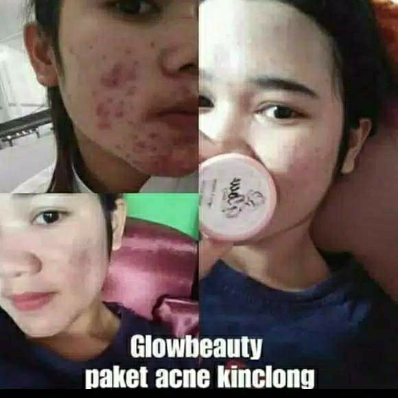 Glow beauty paket normal 2