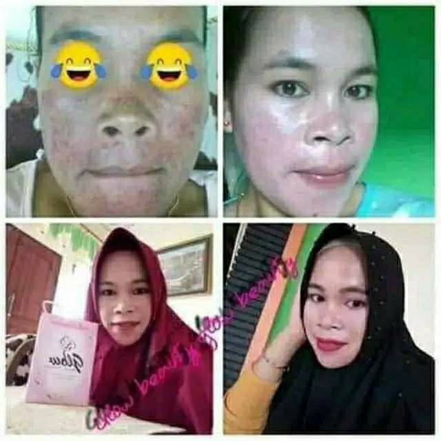 Glow beauty paket normal 4