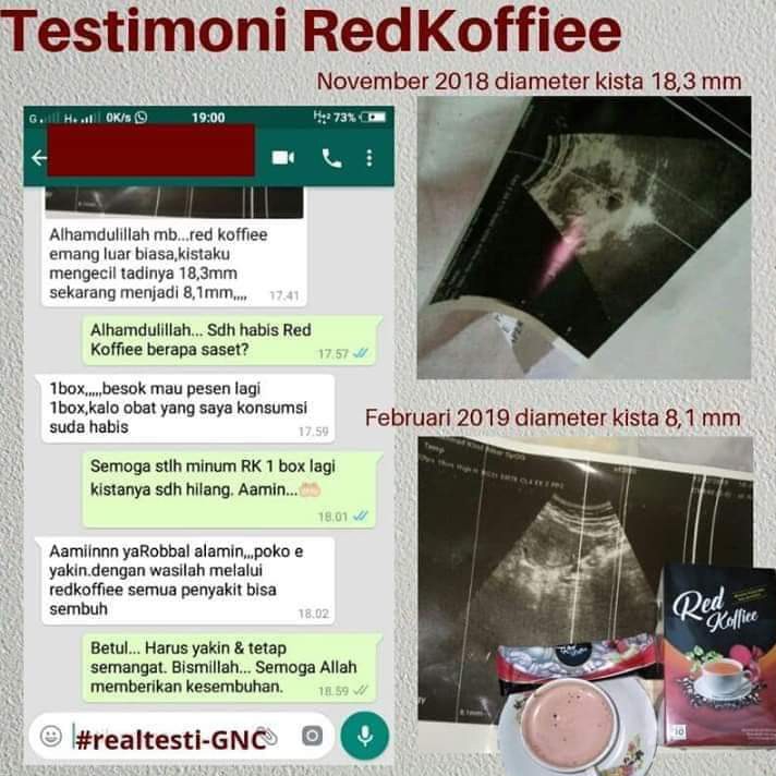 Kopi Kesehatan Redkoffie Obat Segala Penyakit 4