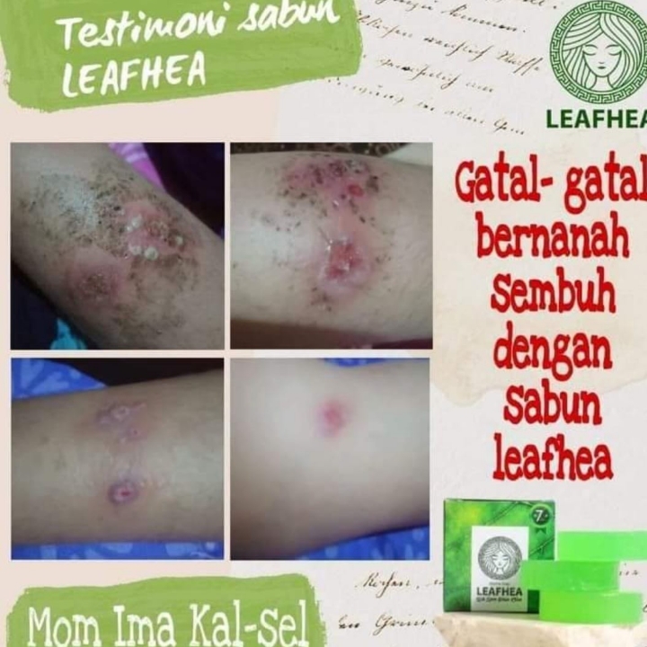 Gluta Soap LEAFHEA 5