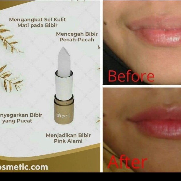 Liptreatment Skincare Untuk Bibir 2