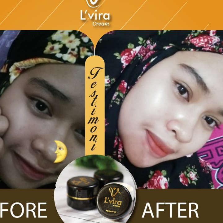 Lvira Cream