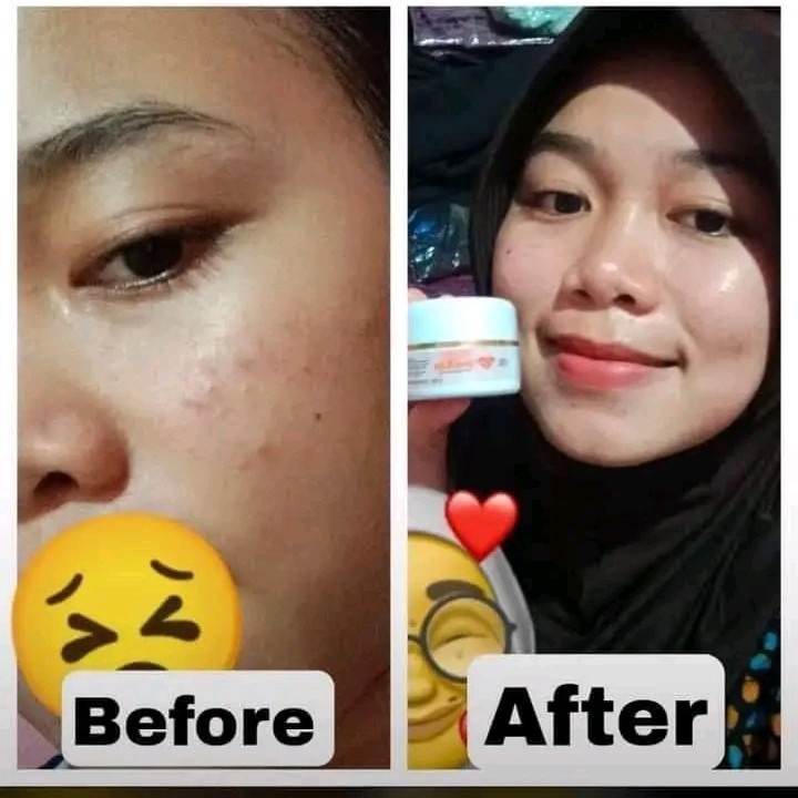 MAXIESKINCARE  4