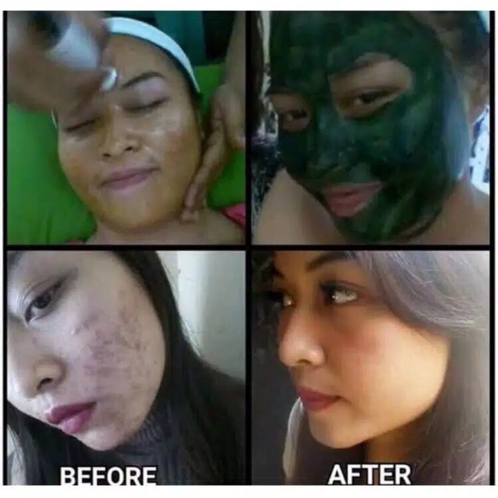 Masker Spirulina