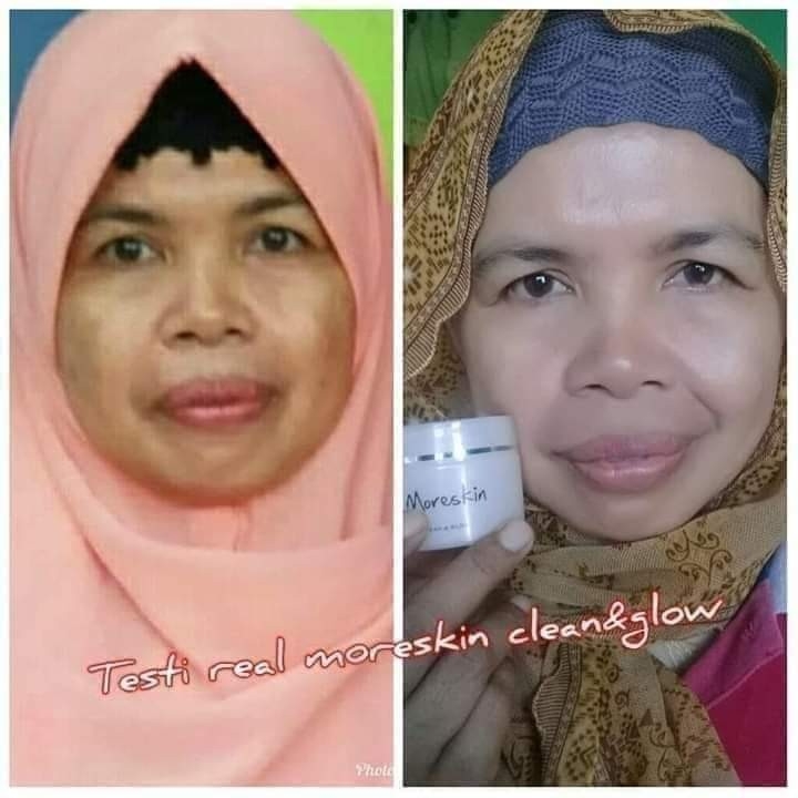 Moreskin Clean Glow 4