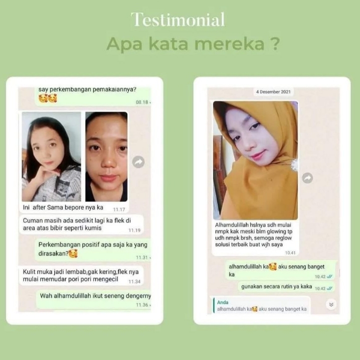 PAKET SERIES REGLOW SKINCARE 