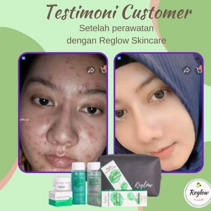 PAKET SERIES REGLOW SKINCARE  2