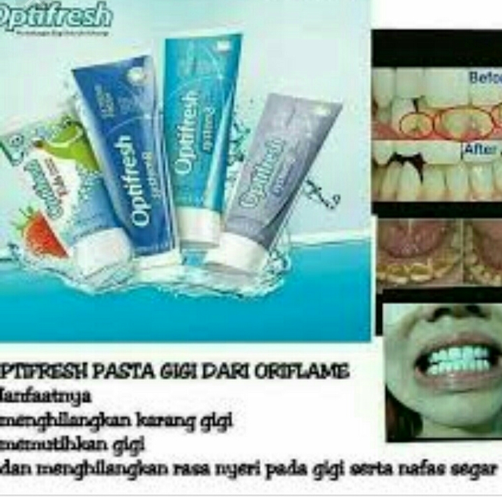 PasTa Gigi OrifLame Optifresh 3