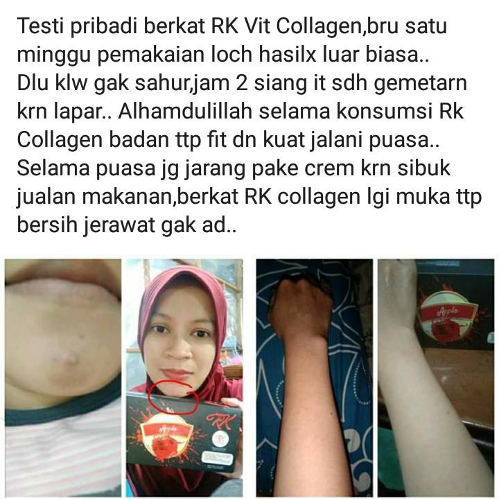 RK VIT COLLAGEN 4