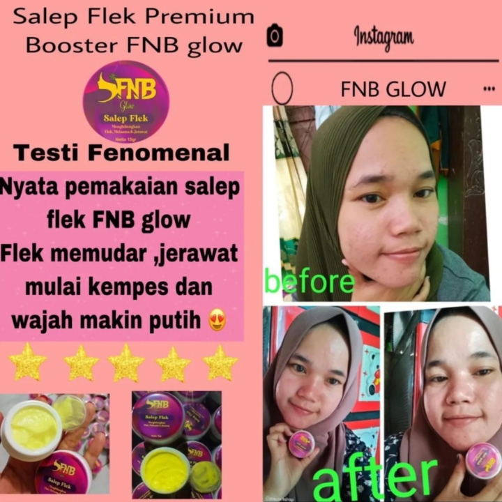 Salep Flek FNB Glow 2