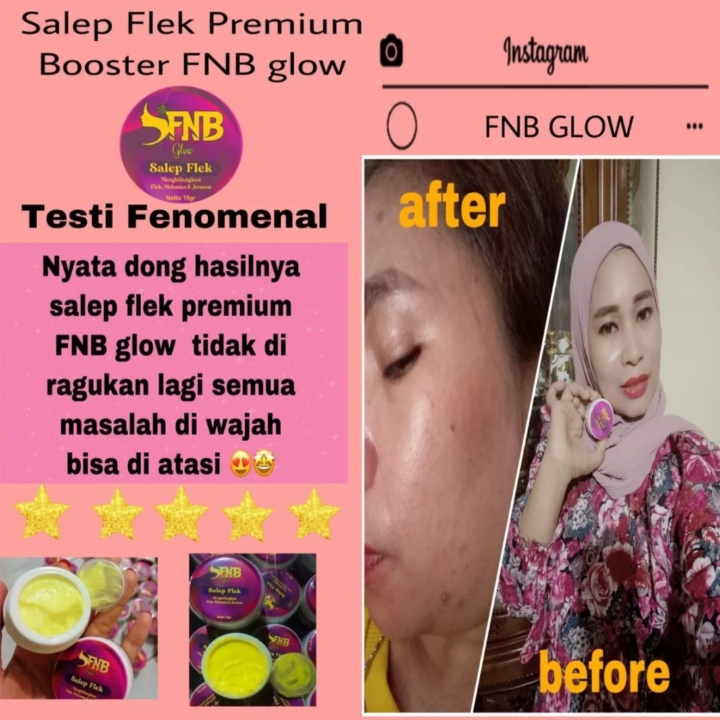 Salep Flek FNB Glow 3