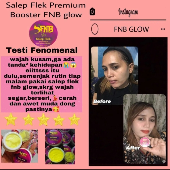 Salep Flek FNB Glow 4