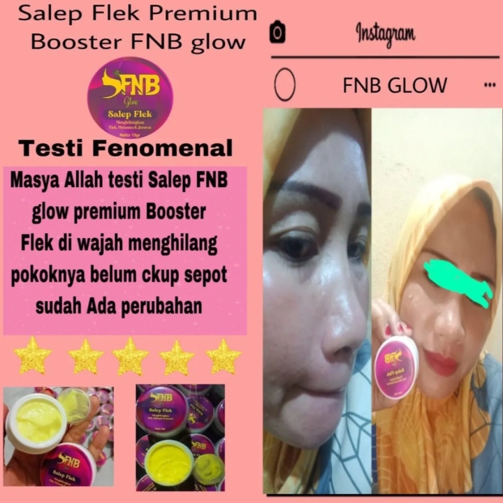 Salep Flek FNB Glow 5