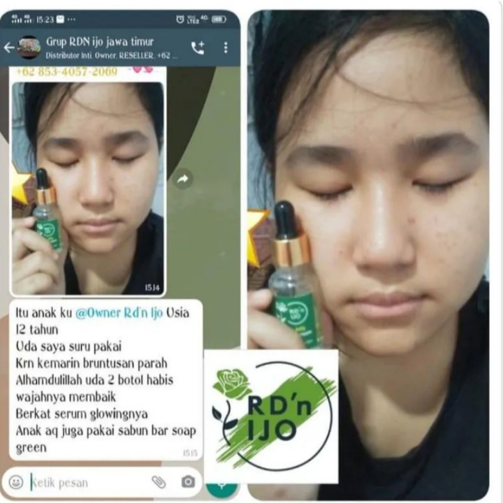 Serum Glowing RDn Ijo 3