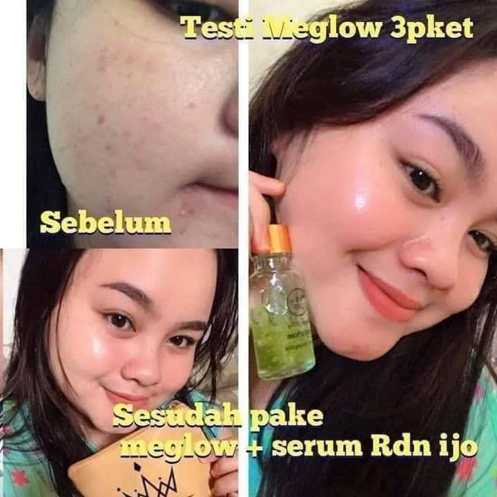 Serum Glowing RDn Ijo 5