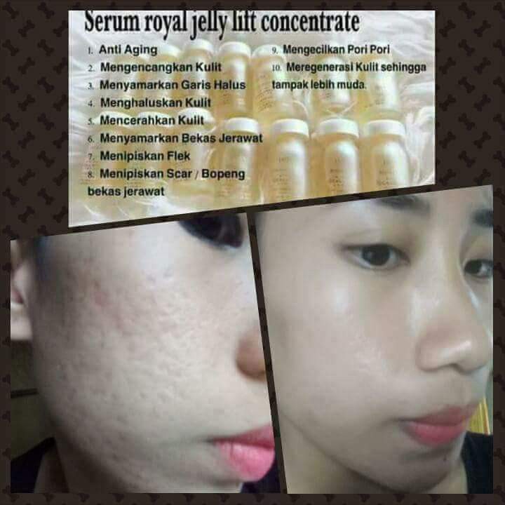 Serum Royal Jelly Lift Concentrate 2