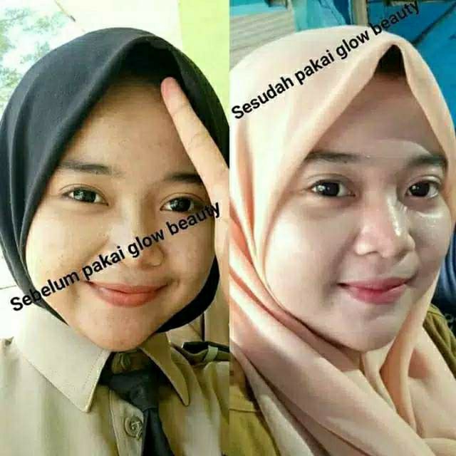 Serum whitening melasma whitening 4