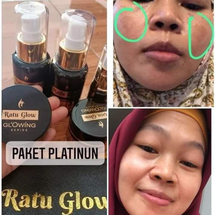 Skincare Ratu Glow Platinum 3