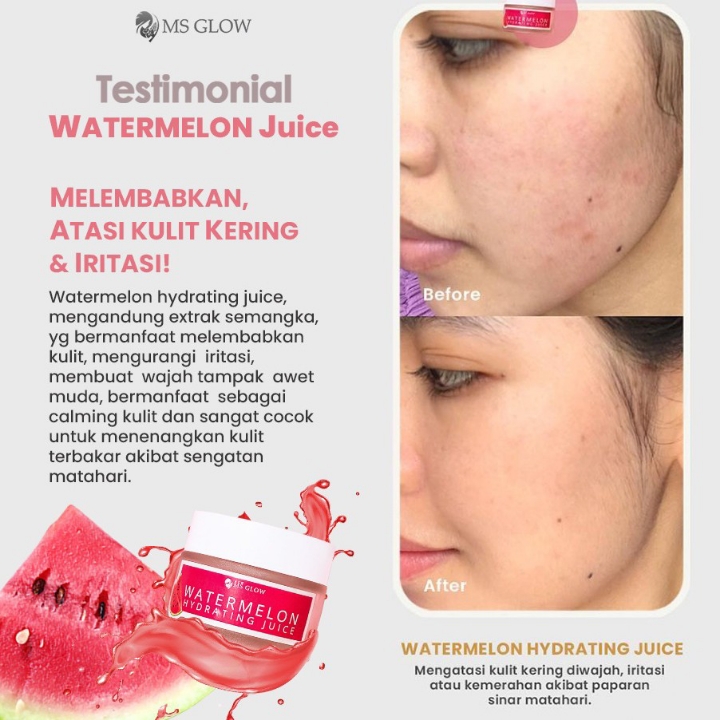 Watermelon Moisturizer 2