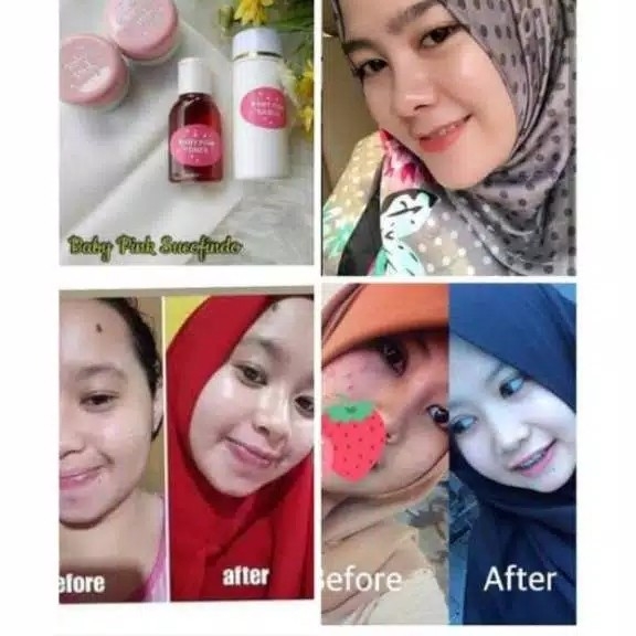 sepaket cream baby pink